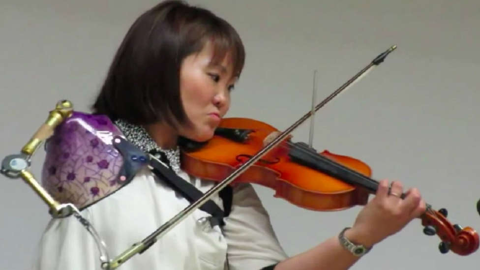 Conoce la historia de Manami Ito, la enfermera que empezó a tocar el violín gracias a un brazo protésico